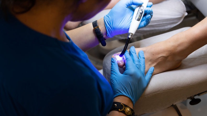 korekta wzrastających paznokci oława