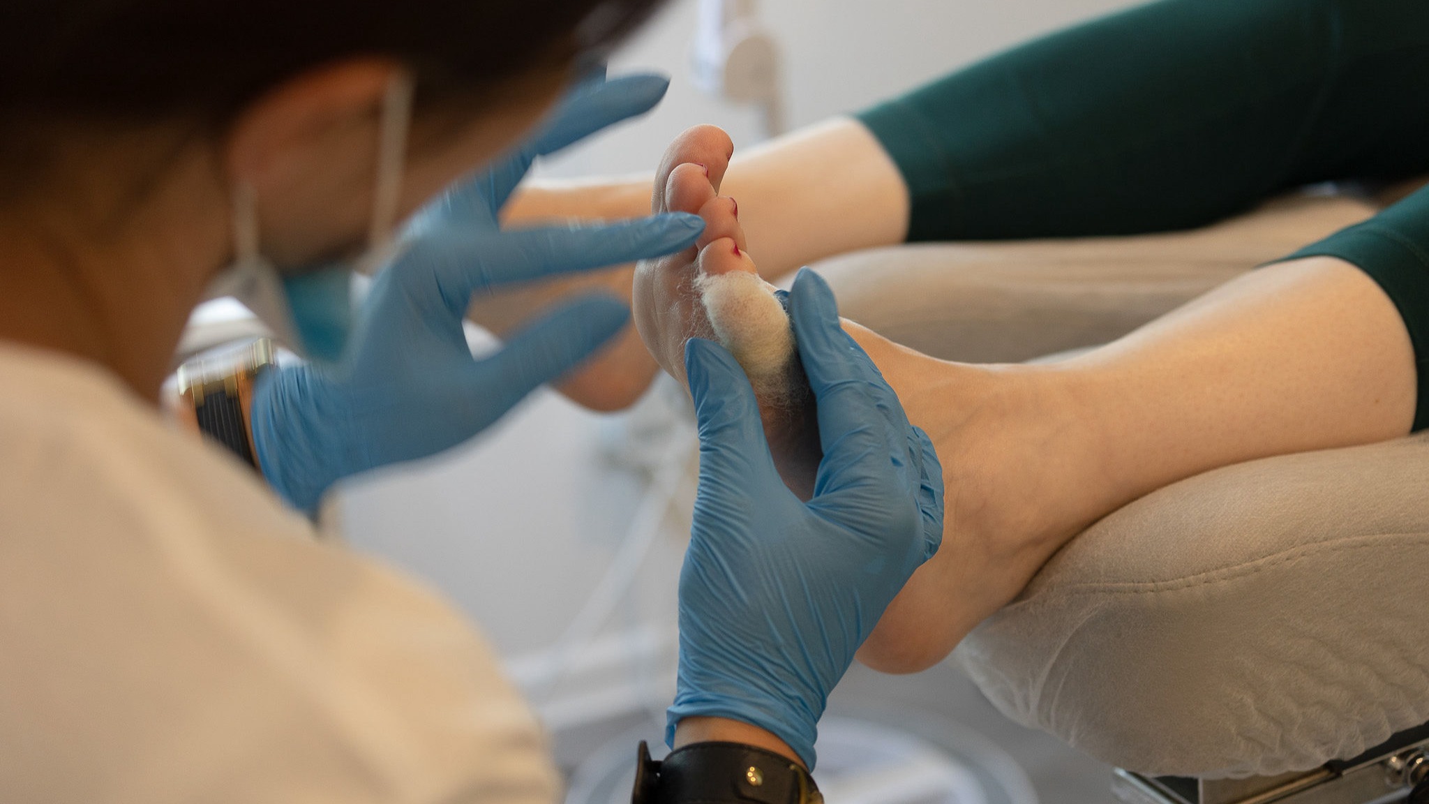 usuwanie odcisków, modzeli i nagniotków, oława