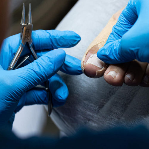 podolog linkowska oława ortopogolog stopy