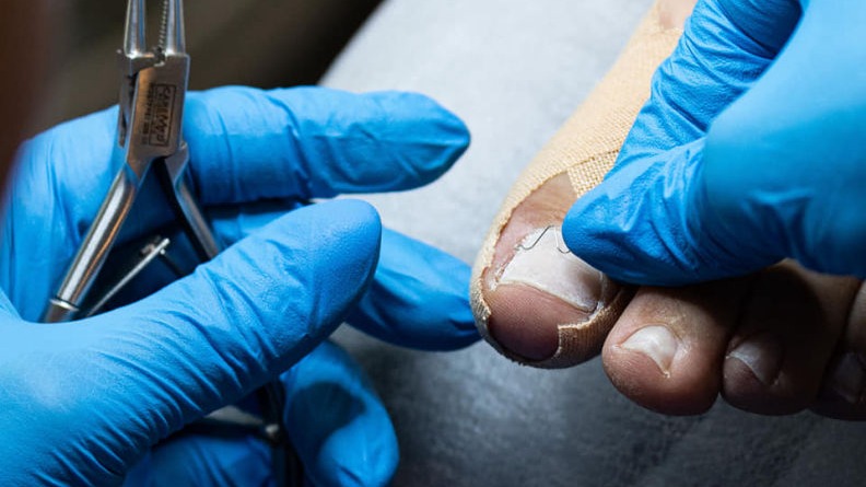 pedicure podologiczny oława